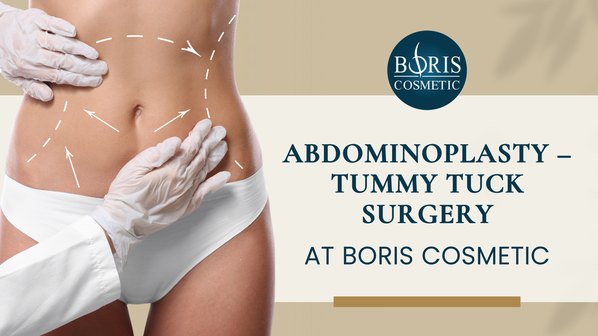 Abdominoplasty Tummy Tuck Surgery Boris Cosmetic LA