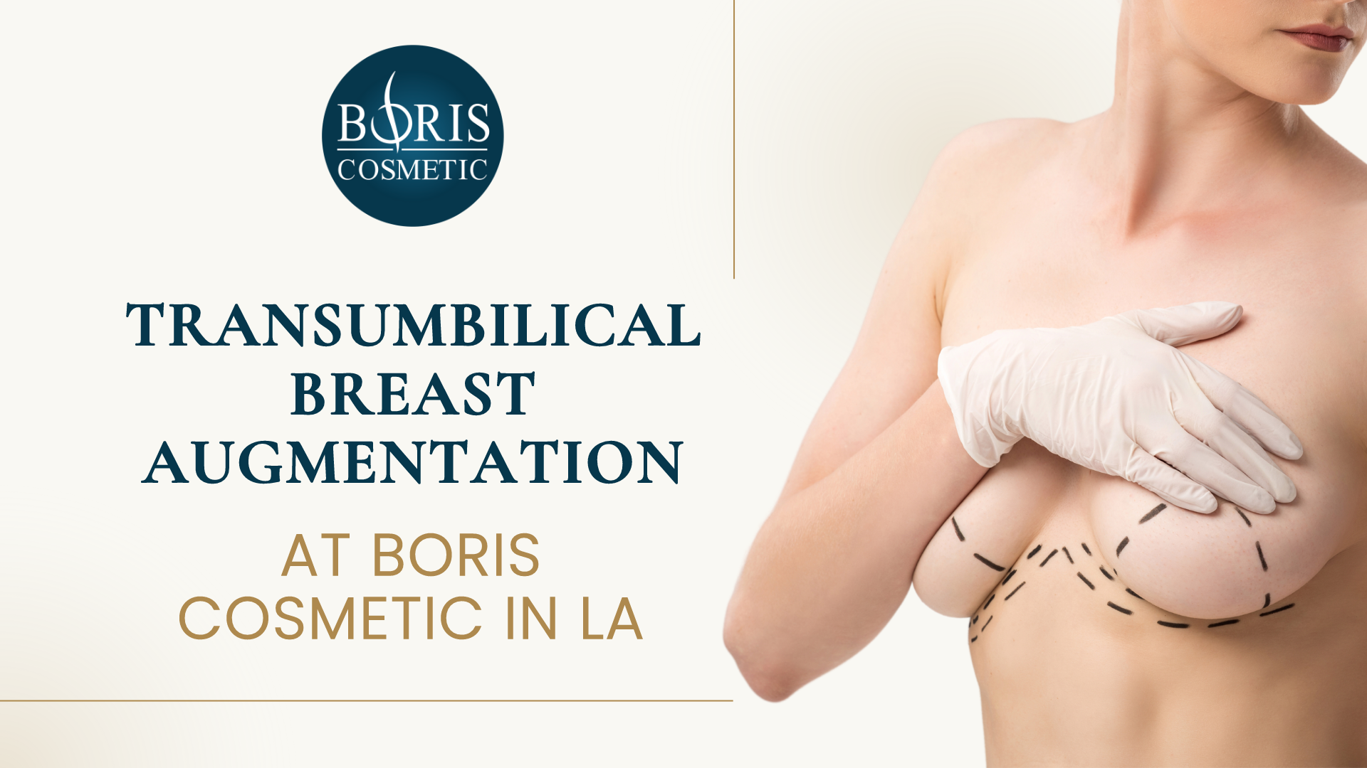 Transumbilical Breast Augmentation Boris Cosmetic LA