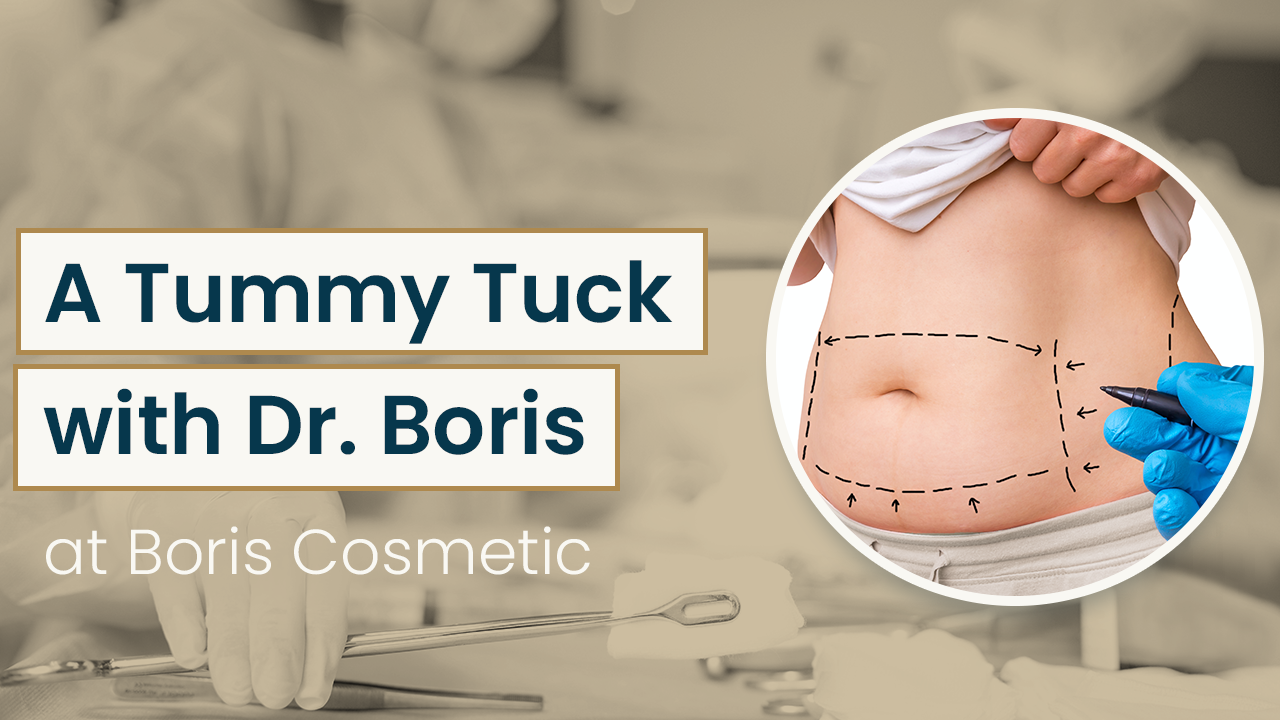 A Tummy Tuck with dr. Boris at Boris Cosmetic