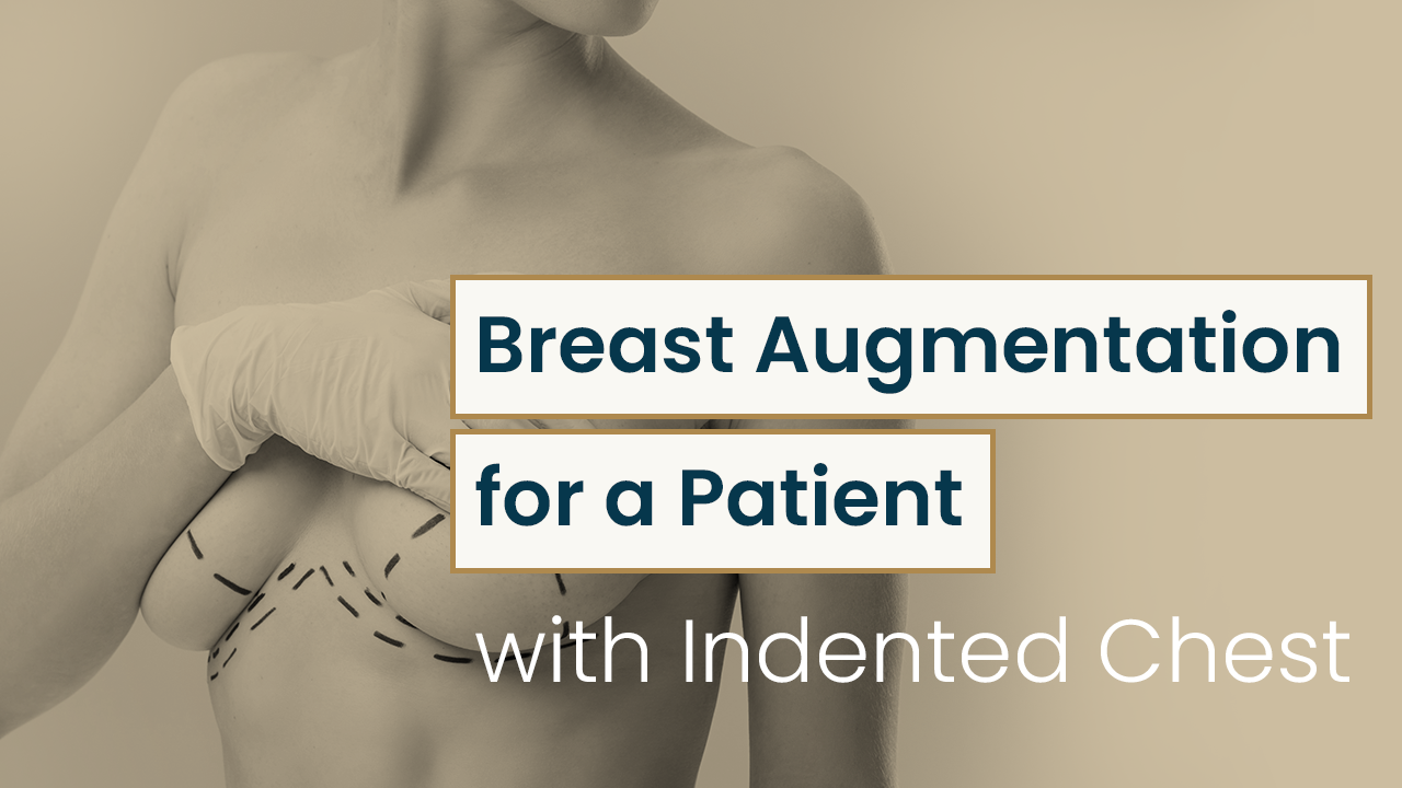 Breast Augmentation for a Patient with Indented Chest
