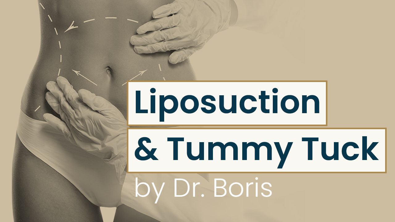 Liposuction & Tummy Tuck by dr. Boris